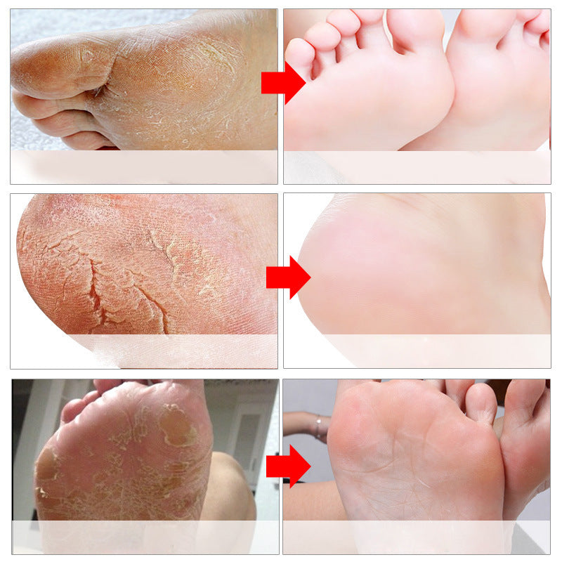 LavenderR ose Foot Mask Dead Skin Calluses Horny Foot Mask